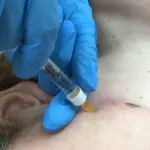 consultas-informativas